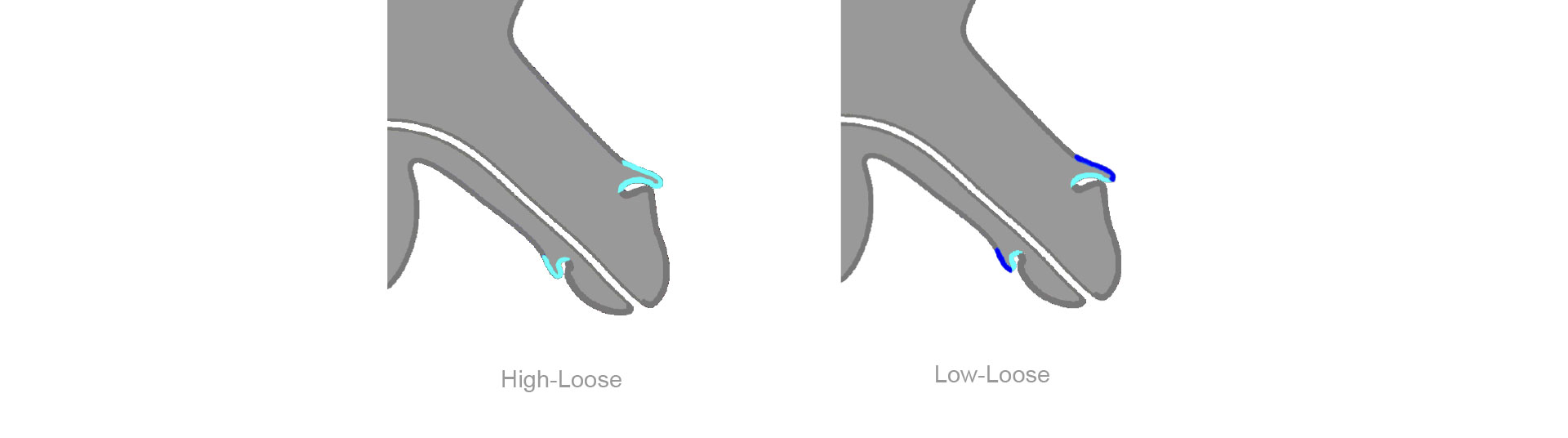 Schematische Darstellung der High-Loose- und Low-Loose- Beschneidung